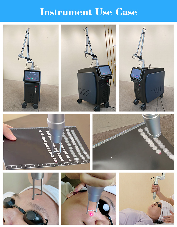Nd Yag Laser Machine17